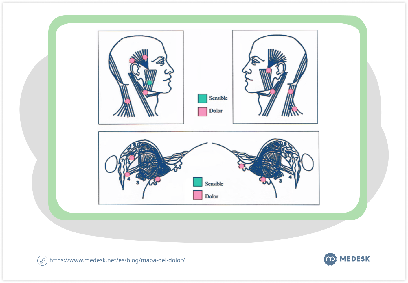 mapa-del-dolor-body-chart-2