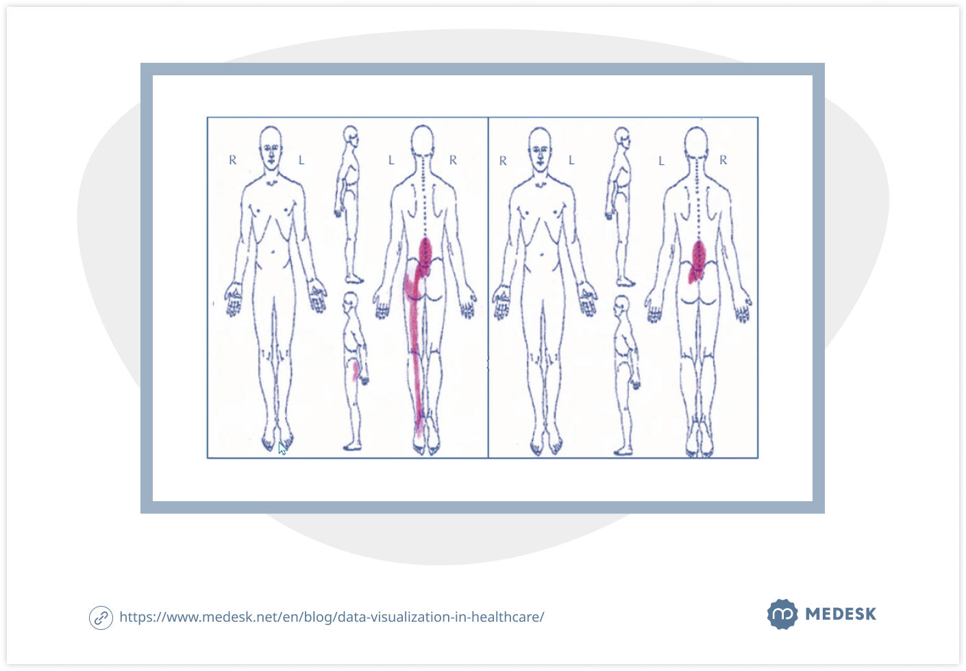data-visualization-in-healthcare-inf1